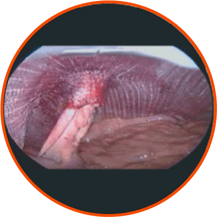 Elastic funnel